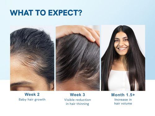 Hair Growth Roll-On Serum