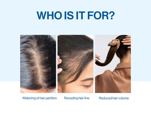 Hair Growth Roll-On Serum